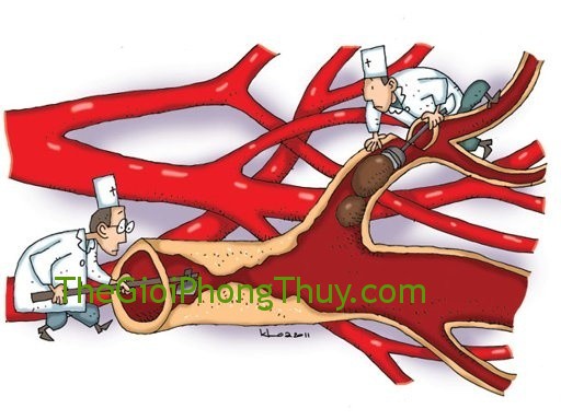 Bệnh ứ máu với những giấc mơ