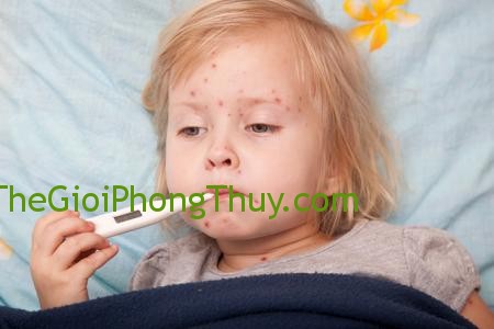 Khi mằn mơ thấy bệnh sởi