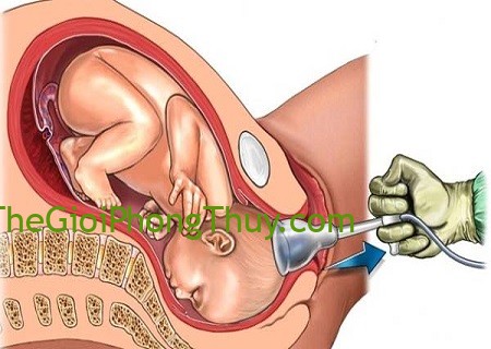 Giấc mơ thấy phá thai có ý nghĩa gì và con số may mắn nên đánh?
